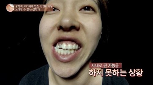 co gai xau xi xinh nhu my nu nhac han sau “dao keo” hinh anh 2