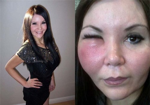 phẫu thuật thẩm mỹ