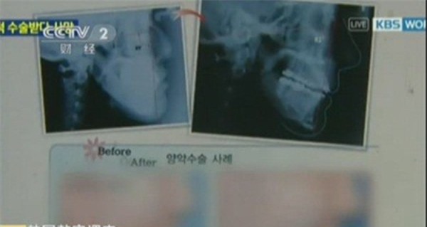 phẫu thuật thẩm mỹ 5