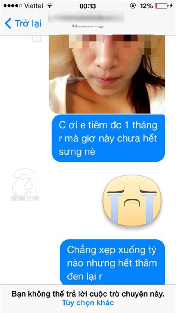 Spa bị tố tiêm chất làm đầy dởm khiến mũi lệch, môi sưng