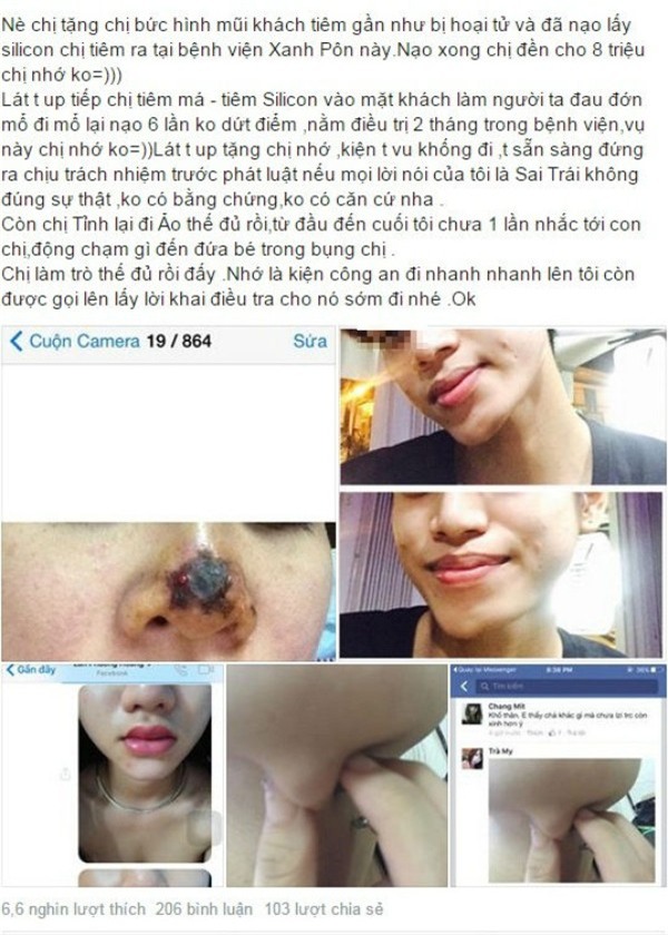 Hàng loạt khách hàng lên tiếng, trưng bằng chứng phẫu thuật hỏng tại spa
