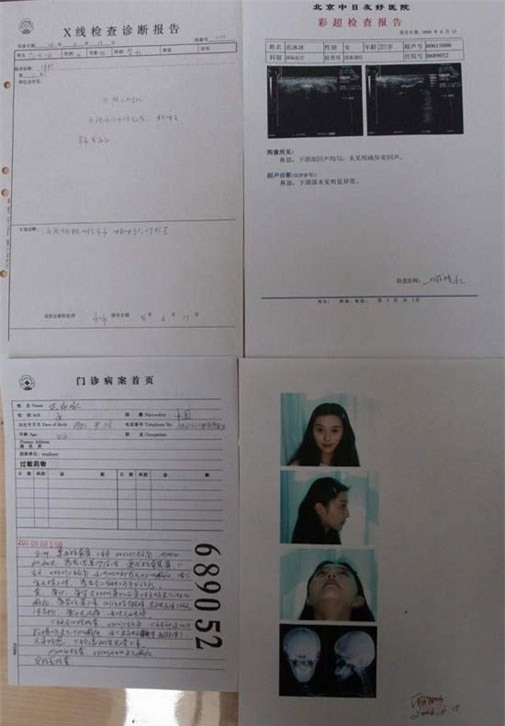 151015starpttm6-6af14