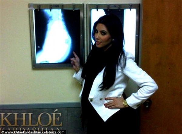 151015starpttm8-22cf8