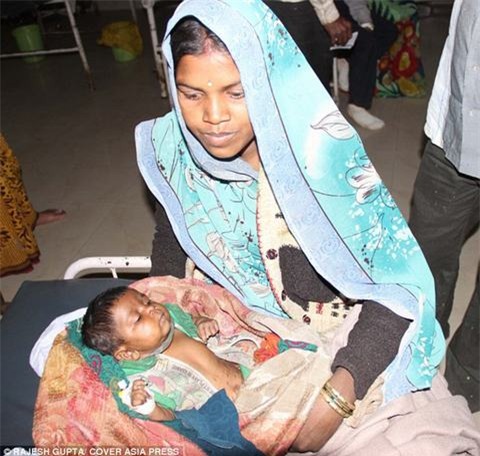 Bé Shivani đã được đưa vào bệnh viện trong tình trạng nguy kịch sau khi được chữa trị theo hủ tục truyền thống