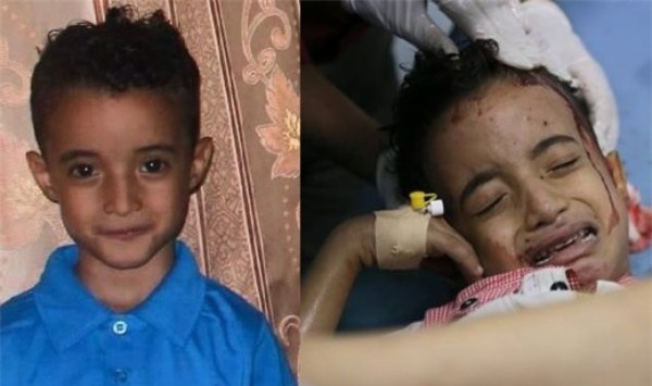 cậu bé đáng thương