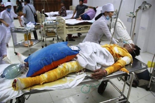 Anh Nhật đang trong tình trạng nguy kịch vì bị bỏng đến 97%.