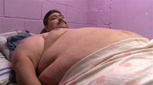 Người đàn ông béo nhất thế giới cắt 70% dạ dày để giảm cân - Ảnh 1