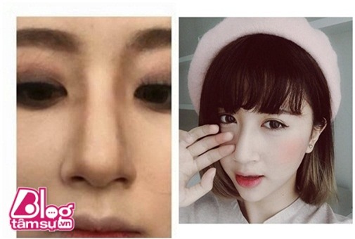 quynh anh blogtamsu12