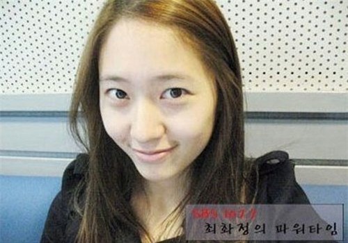 ca si co co bung dep nhat xu han bi nghi “dao keo” hinh anh 5