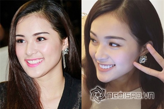 Tình mới Cường Đô la để lộ vết tích dao kéo cằm 5