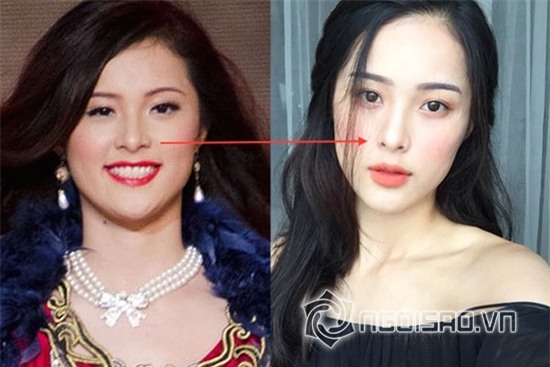 Tình mới Cường Đô la để lộ vết tích dao kéo cằm 6