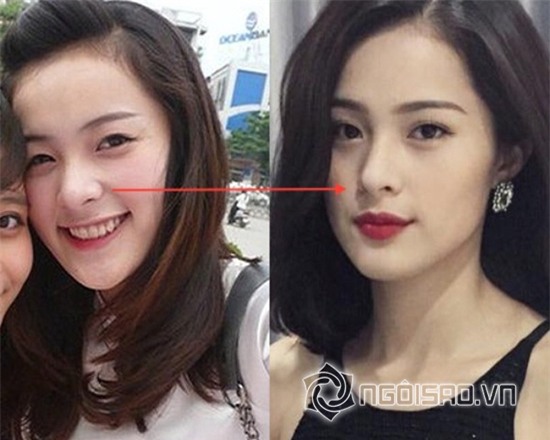 Tình mới Cường Đô la để lộ vết tích dao kéo cằm 8