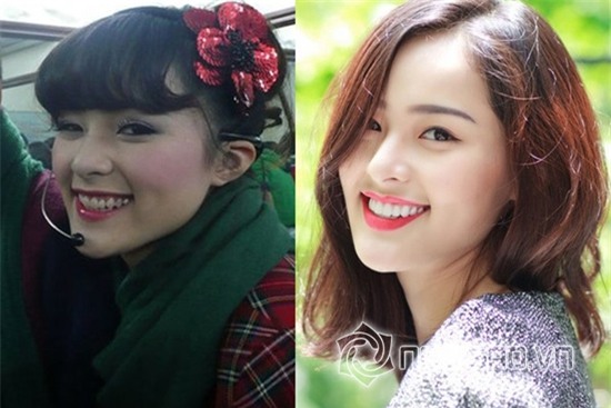 Tình mới Cường Đô la để lộ vết tích dao kéo cằm 2