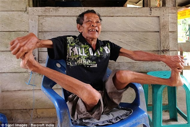 Khả năng bẻ hai chân ra hai bên quái dị