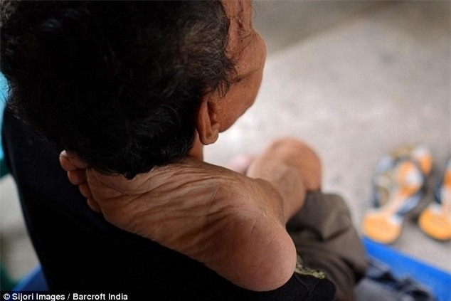 Vắt chân ngược lên đầu