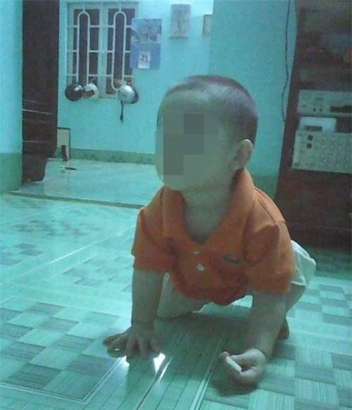 be 22 thang tuoi thuong tich day minh sau 2 ngay di hoc hinh anh 1