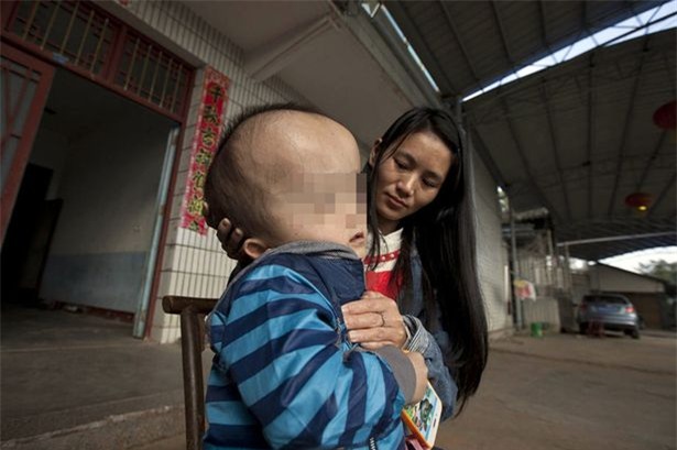 cau be co dau nang bang nua trong luong co the hinh anh 1