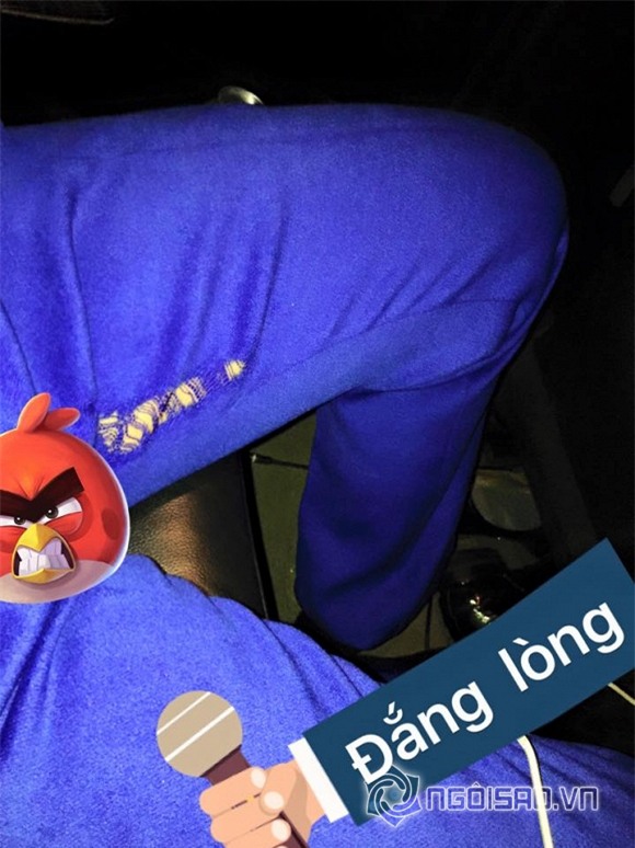 Minh quân rách quần 1