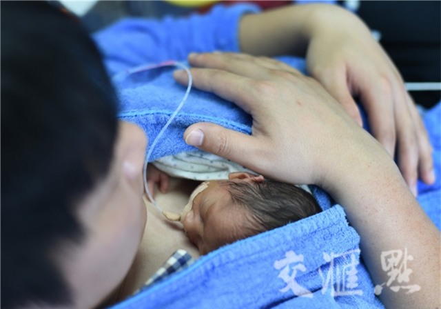 Hình ảnh hai ông bố ôm con sinh non cho bú gây xúc động - Ảnh 2