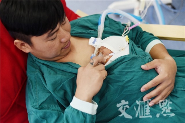 Hình ảnh hai ông bố ôm con sinh non cho bú gây xúc động - Ảnh 3