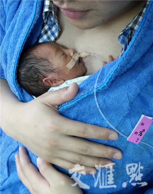 Hình ảnh hai ông bố ôm con sinh non cho bú gây xúc động - Ảnh 4