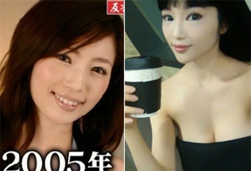 dien vien nhat ban “hoa” bup be nguoi lon vi tham my hinh anh 3