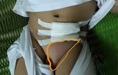 a