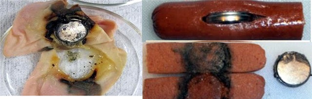 pin cuc ao, nuot pin, bong co hong, tre em, rui ro, pin cúc áo, nuốt pin, bỏng cổ họng, trẻ em, rủi ro, tử vong