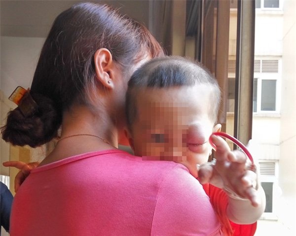 viêm nội nhãn, Bệnh viện Mắt Trung ương, viêm giác mạc, mù mắt