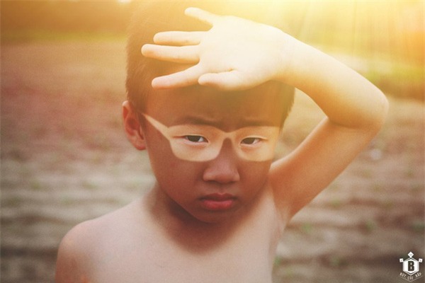 Bộ ảnh cận thị