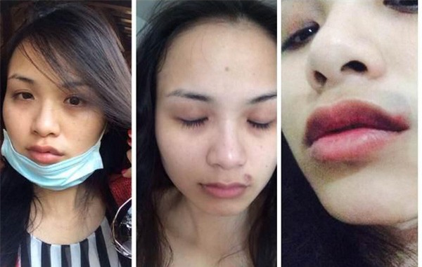 anh1-9383-1396404391-b190d