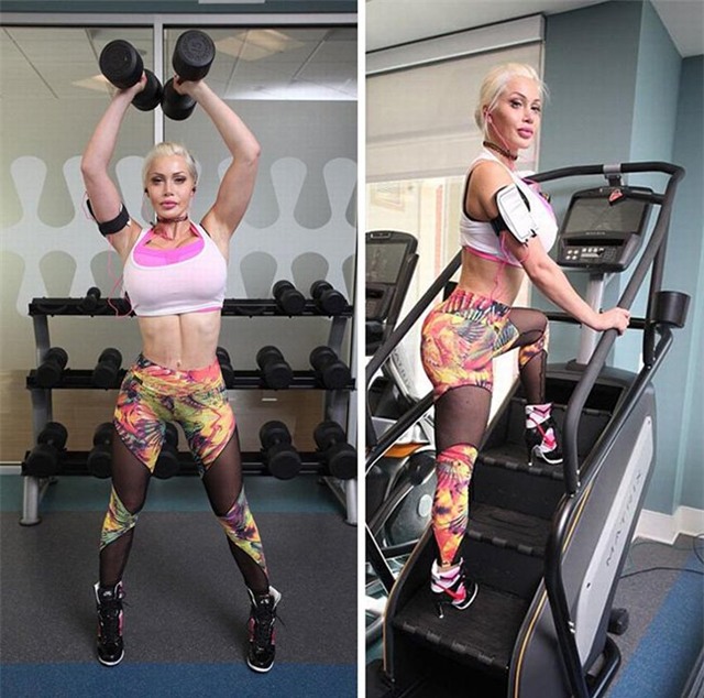 chum anh: co gai chi 2,7 ty de... cat bo xuong suon hinh anh 7