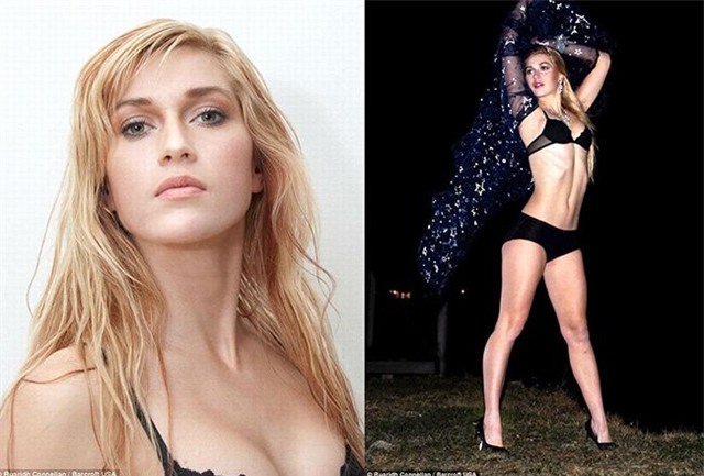 chum anh: co gai chi 2,7 ty de... cat bo xuong suon hinh anh 8