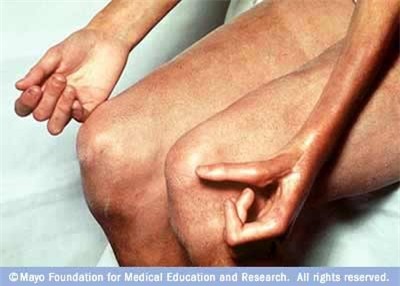 4 căn bệnh da liễu gây tử vong ít người biết