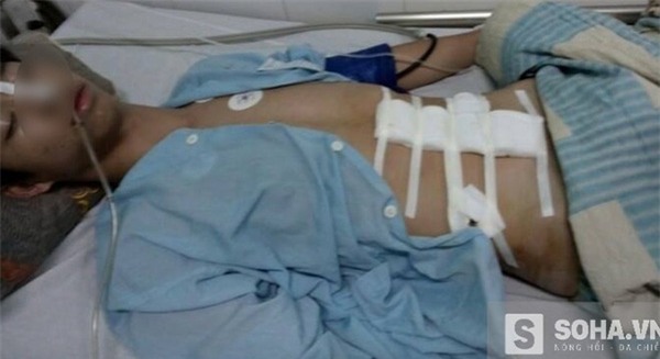 Đâm thủng bụng lớp trưởng vì không cho lấy ghế - Ảnh 1.