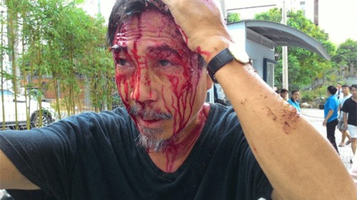 chung cư 4s, côn đồ tấn công, chủ đầu tư, cư dân, đánh nhau, tranh chấp