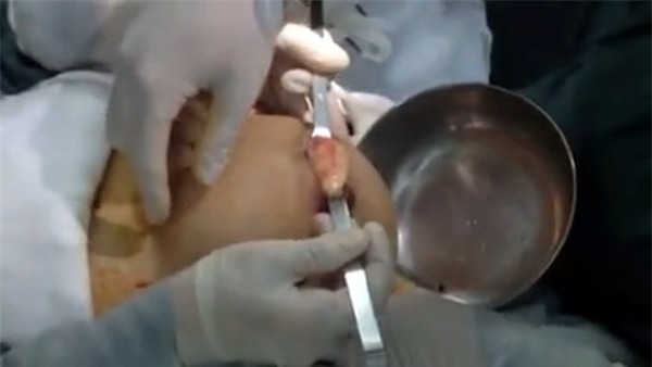 Phẫu thuật thẩm mỹ