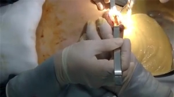 Phẫu thuật thẩm mỹ