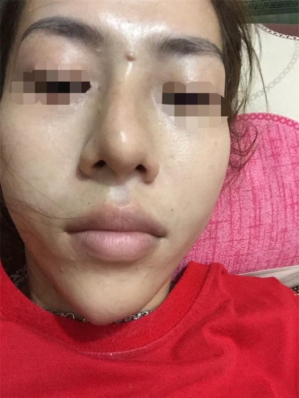 Phãu thuật thẩm mỹ