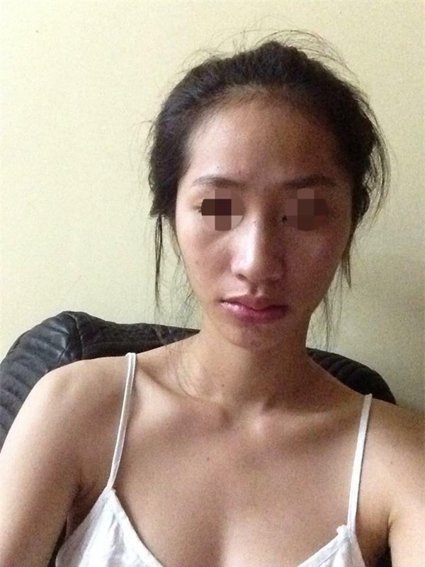 Phãu thuật thẩm mỹ