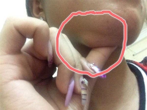 Phãu thuật thẩm mỹ