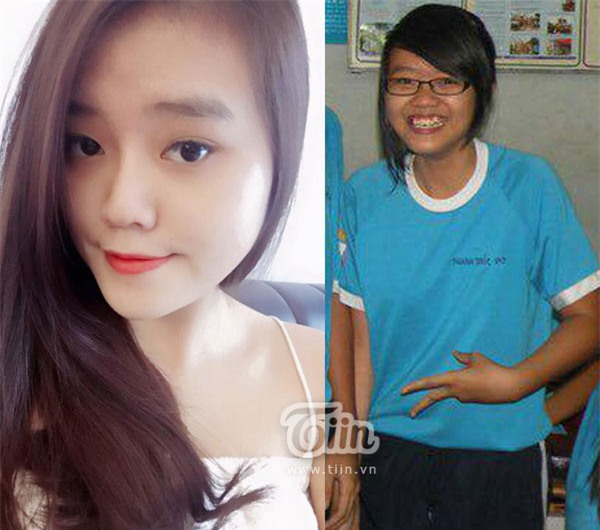 Cô bạn kiếm 200 triệu mỗi tháng nhờ việc chữa mụn