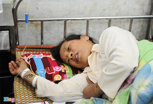 'Thần chết đã gọi rồi mà tôi chỉ bị gãy ngón chân'