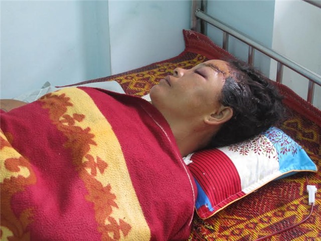 Đánh mẹ ruột tay gãy thành 3 khúc vì không cho tiền - 1