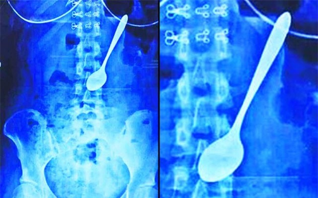 nhung hinh anh ky quac va hai huoc nhat nam qua hinh anh 7