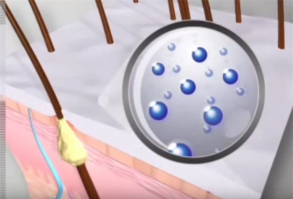 dùng nước có ga để rửa mặt