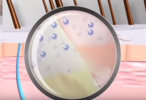 dùng nước có ga để rửa mặt