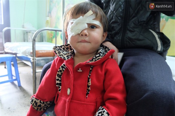 Gia cảnh bần cùng của bé gái 2 tuổi bị… khoét mắt vì ung thư võng mạc - Ảnh 2.