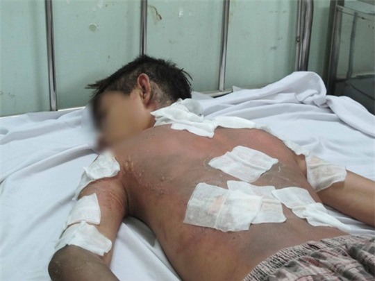 Truy nã thiếu niên tạt xăng đốt học sinh - Ảnh 2.