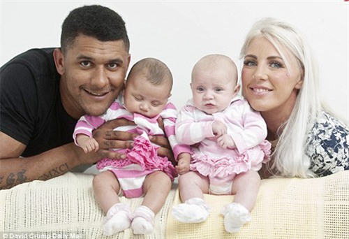 ky la: cap song sinh khac nhau mau da - 1